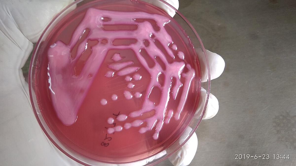 Klebsiella pneumoniae incubándose en un laboratorio.