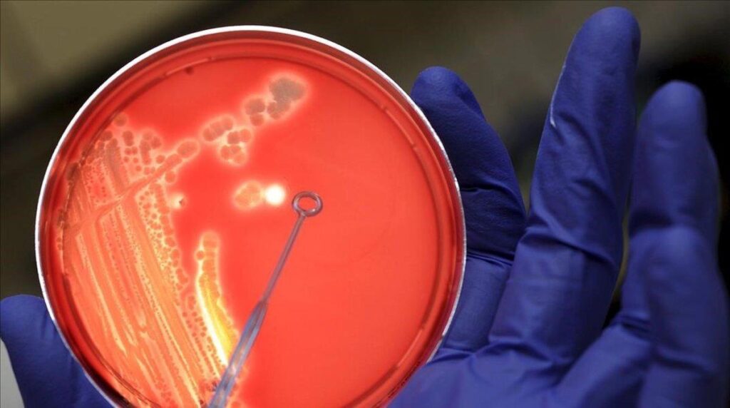 BACTERIA KLEBSIELLA | ¿Qué es la bacteria klebsiella y cómo se contagia? 5 claves