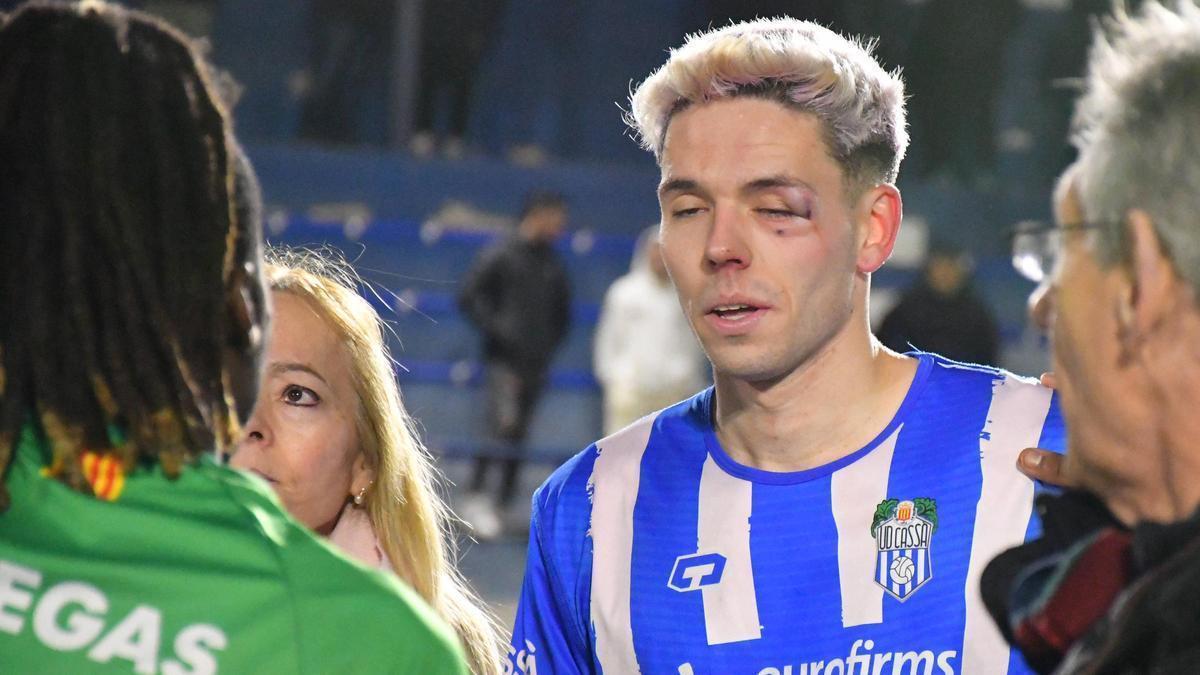 Notario ha sufrido una fractura en el pómulo izquierdo.