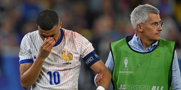 Austria 0 - Francia 1: Francia gana, pero no mete miedo y podría perder a Mbappé