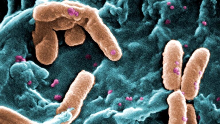 La septicemia o sepsis está causada sobre todo por bacterias