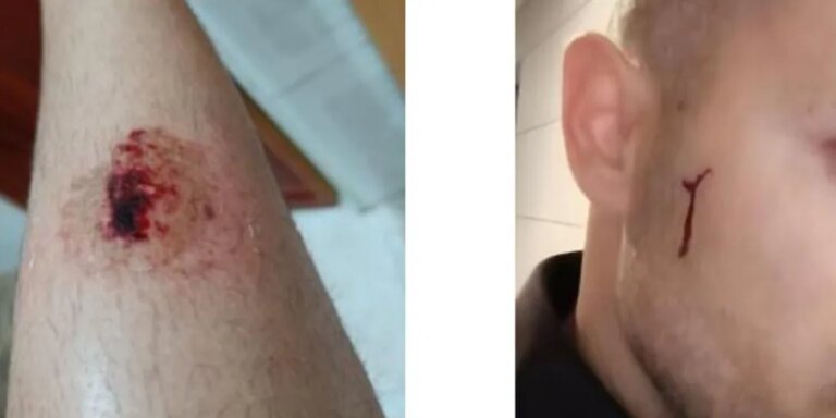 Cuatro policías agredidos por un delincuente al no poder utilizar su pistola táser por un problema informático