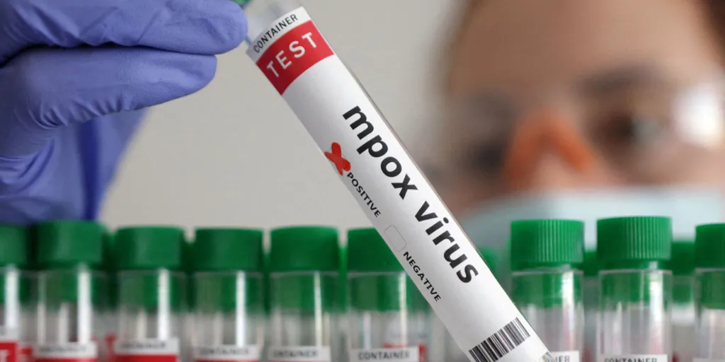 España descarta vacunar a todos los viajeros que vayan a los países más afectados por la viruela del mono