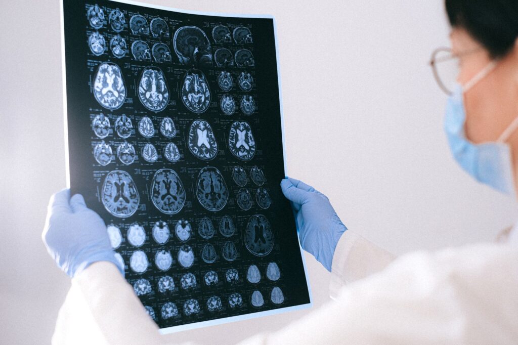 Quirónsalud Murcia y AFADE lanzan una iniciativa para prevenir el deterioro cognitivo antes de los síntomas