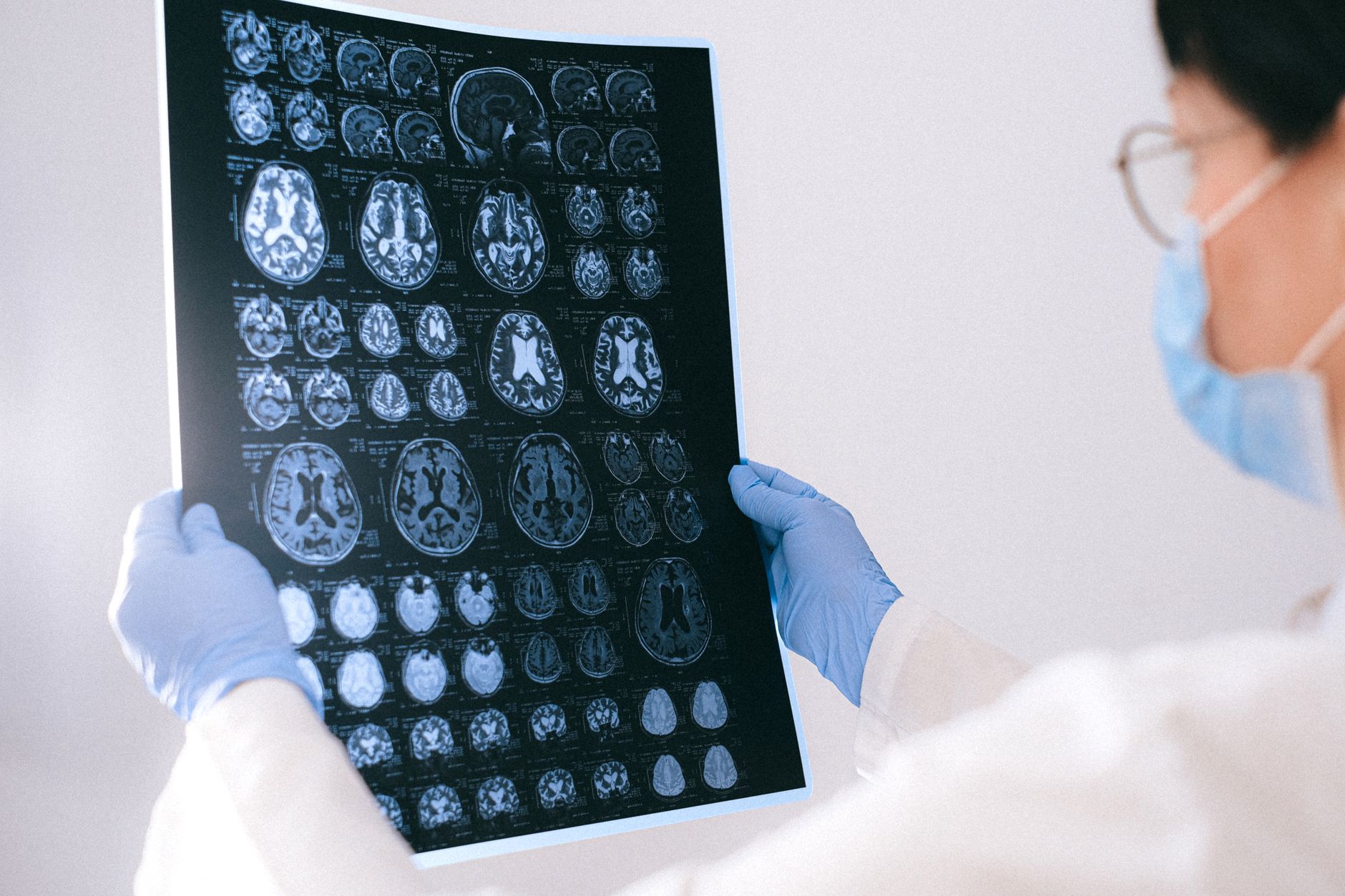 Quirónsalud Murcia y AFADE lanzan una iniciativa para prevenir el deterioro cognitivo antes de los síntomas